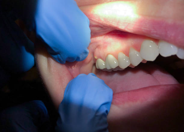 Best Emergency Gum Pain Relief  in Herlong, CA