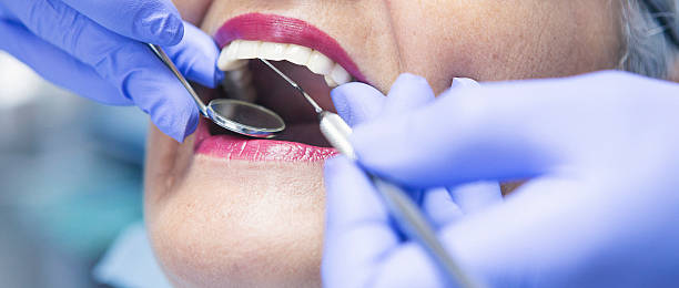 Best Chipped Tooth Repair Near Me  in Herlong, CA